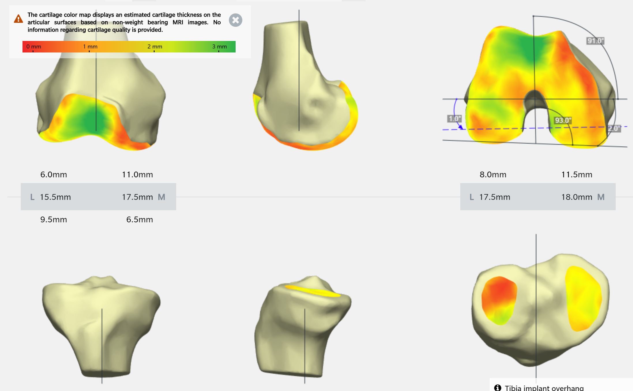 Neues Kniegelenk My Knee Salzburg Dr. Planitzer