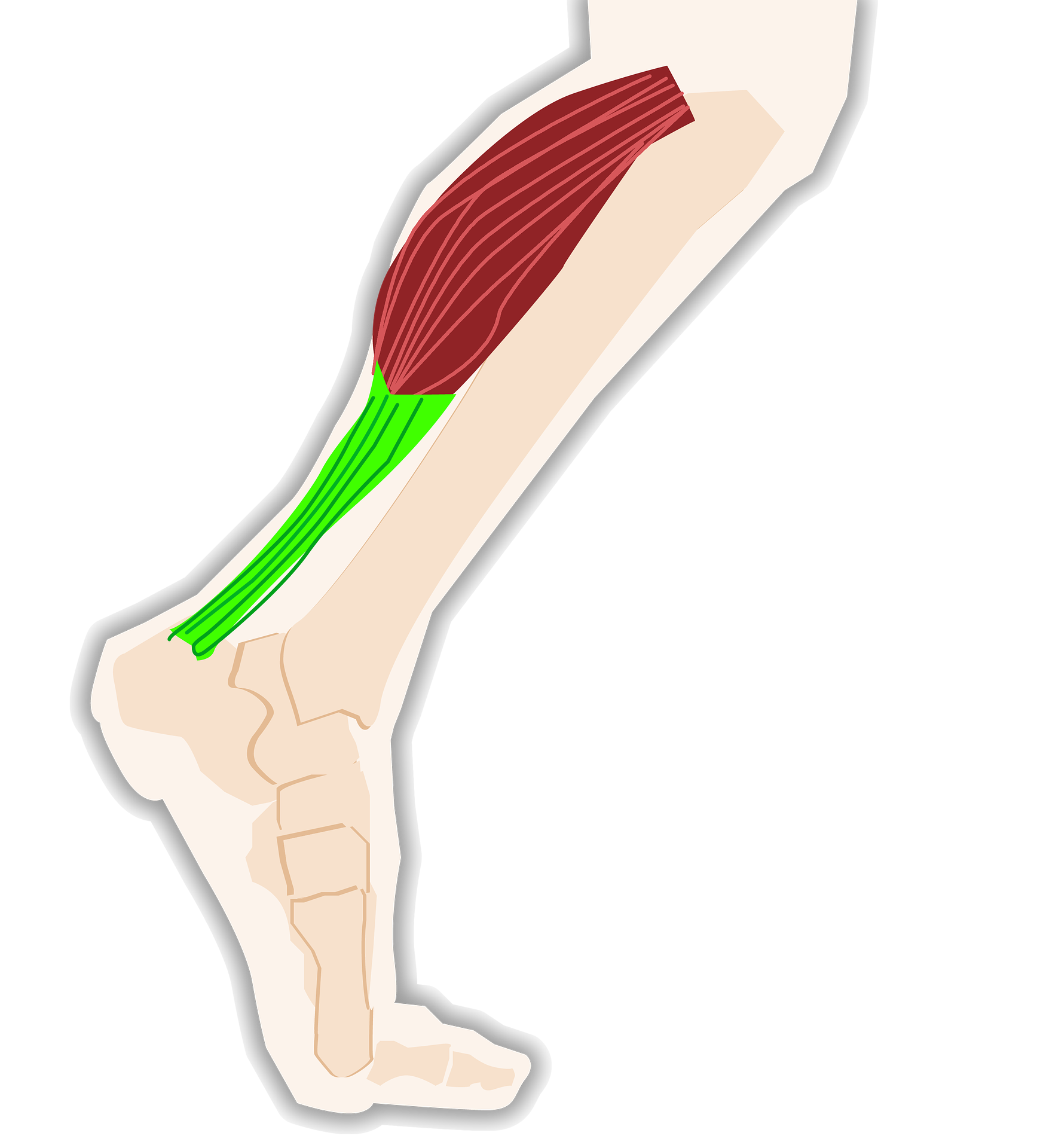 Achillessehne SAlzburg Orthopäde Salzburg Dr. Planitzer